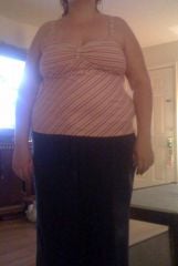 5 days post op (14 pounds down)