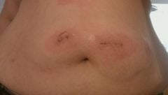 Day 9 Went to Dr. closer pic