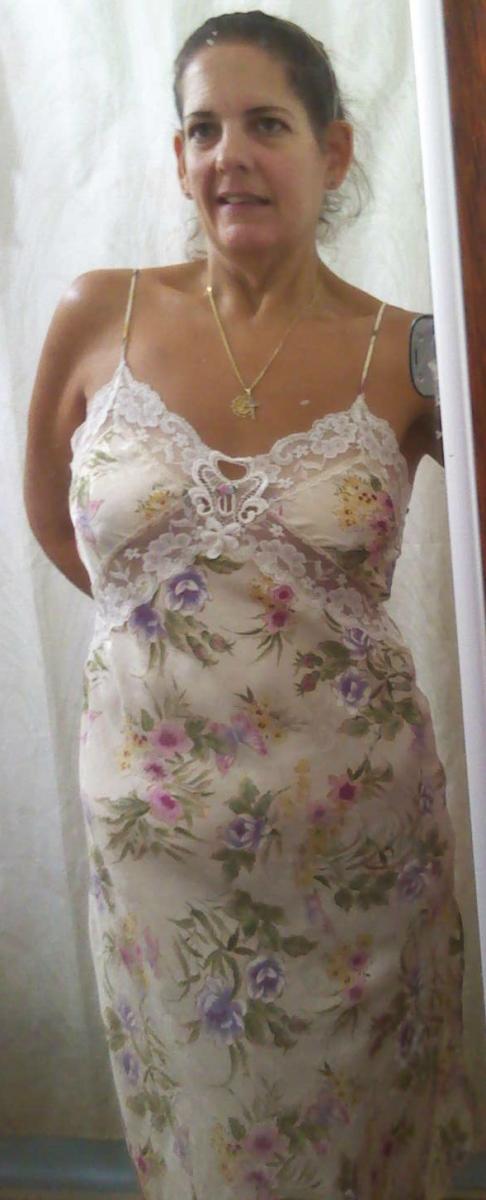 Me almost 2 yrs after surgery