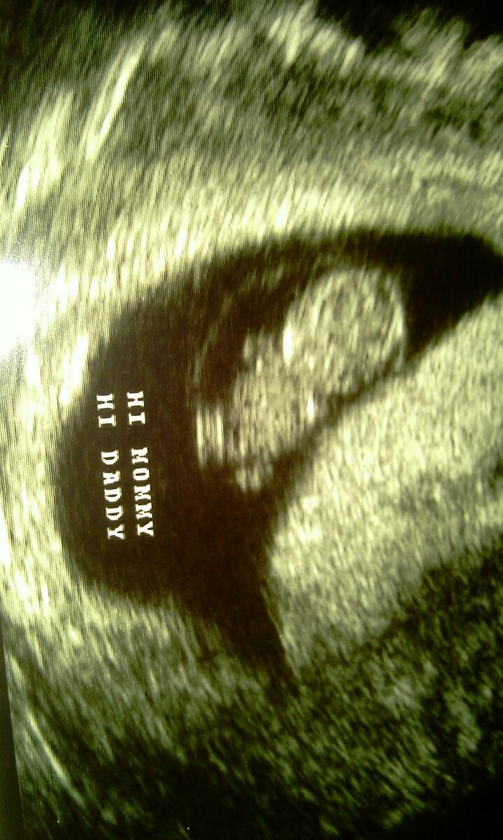 Expecting First Grandbaby