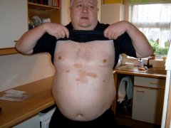 First Operation Scars