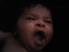 My booboo