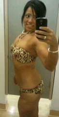 22 Months Post Op :)