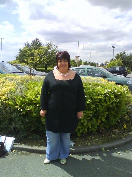 pre op & post ... progression ... surgery sept 26th 2008