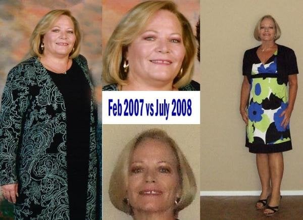 Before & After