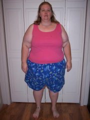 8-8-08 4 days post-surgery 
296 lbs/8 lbs lost from pre-surgery
