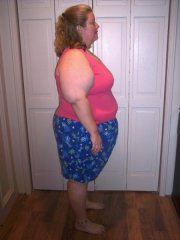 8-8-08 4 days post-surgery 
296 lbs/8 lbs lost from pre-surgery