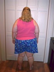 8-8-08 4 days post-surgery 
296 lbs/8 lbs lost from pre-surgery