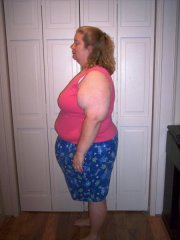 8-8-08 4 days post-surgery 
296 lbs/8 lbs lost from pre-surgery