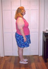 11-8-08 3 months after surgery
258.8 lbs/45.2 lbs lost
