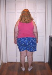 11-8-08 3 months after surgery
258.8 lbs/45.2 lbs lost