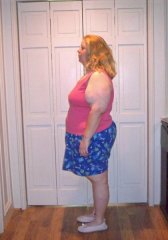 11-8-08 3 months after surgery
258.8 lbs/45.2 lbs lost