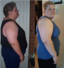4 months post op