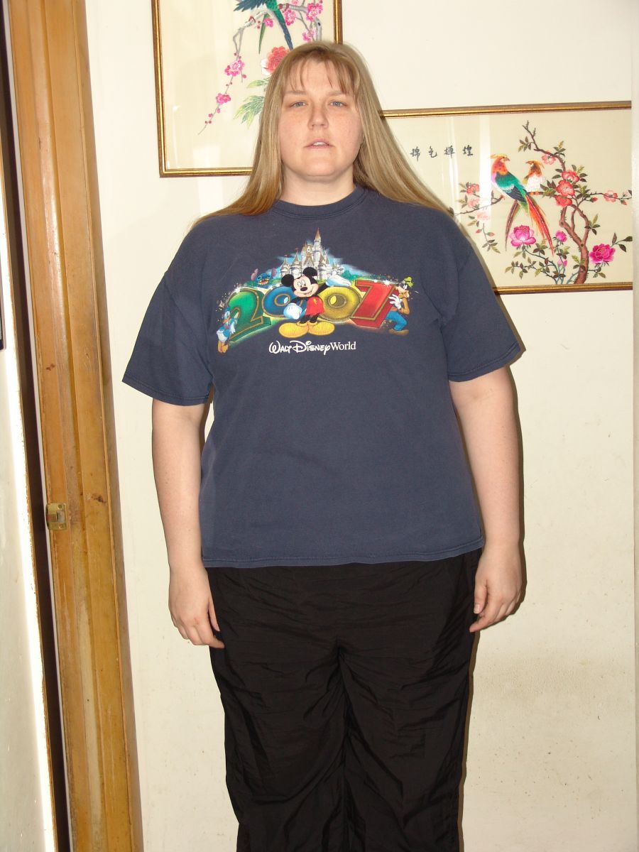 ASIL72's Before and After Pics