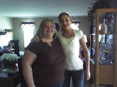 One month before surgery.