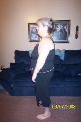 1 month post op
225 lbs