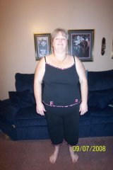 1 month post op
225 lbs