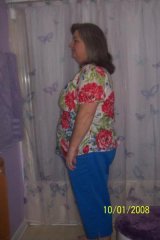 2 months post-op
211 lbs