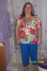 2 months post-op
211 lbs