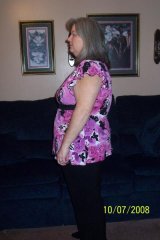 2 month post-op visit
211 lbs