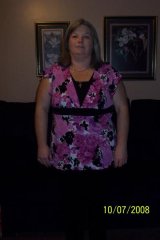 2 month post-op visit
211 lbs