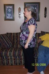 4 months post op
204 lbs
