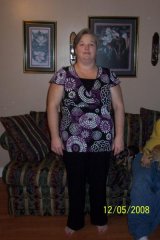 4 months post op
204 lbs