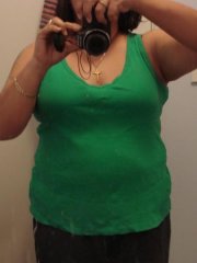 3 weeks postop - almost 20lbs lighter