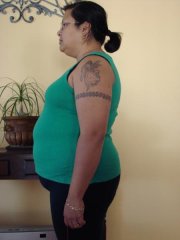 3 weeks preop side