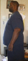 side view 49 days post-op. 60lbs down