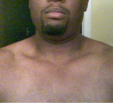 Random