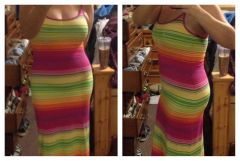1 month PO tummy tuck & breast reduction/lift