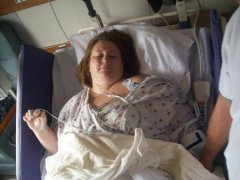RIGHT AFTER SURGERY