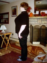 Three months one week post-op
182 pounds 11/15/08