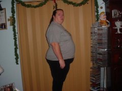 Me on Dec 25, 2007 the day before surgery