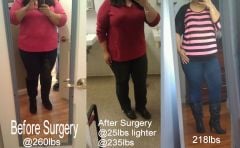 260 235 218 Before After Dressed