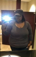 -41lbs 4mths post op