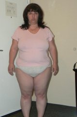 This is me the night before my banding...
March 5 08. 247lbs