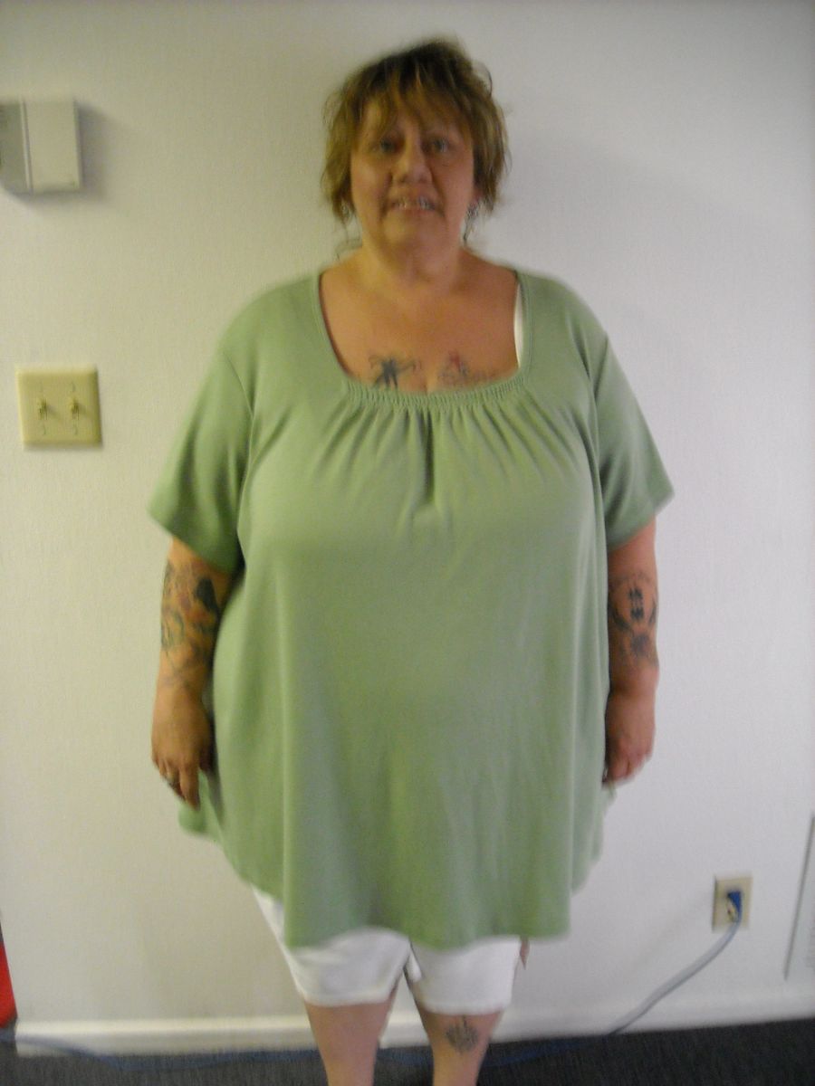 before pics