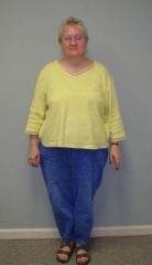 JM pre-op front color.jpg