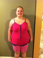 Before LapBand 02262012.jpg