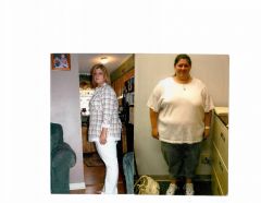 First lap-band... May 2005 357lbs to 210 lbs.JPG