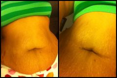 Incision Update