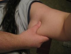 IMG 4556