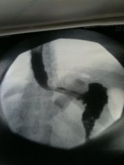 PostSurgury Of My Band 2010