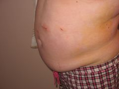 IMG 9657