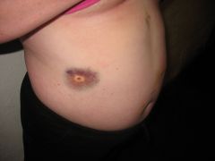 IMG 9668
