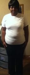 9 days post-op (front)