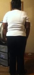 9 days post-op (back)