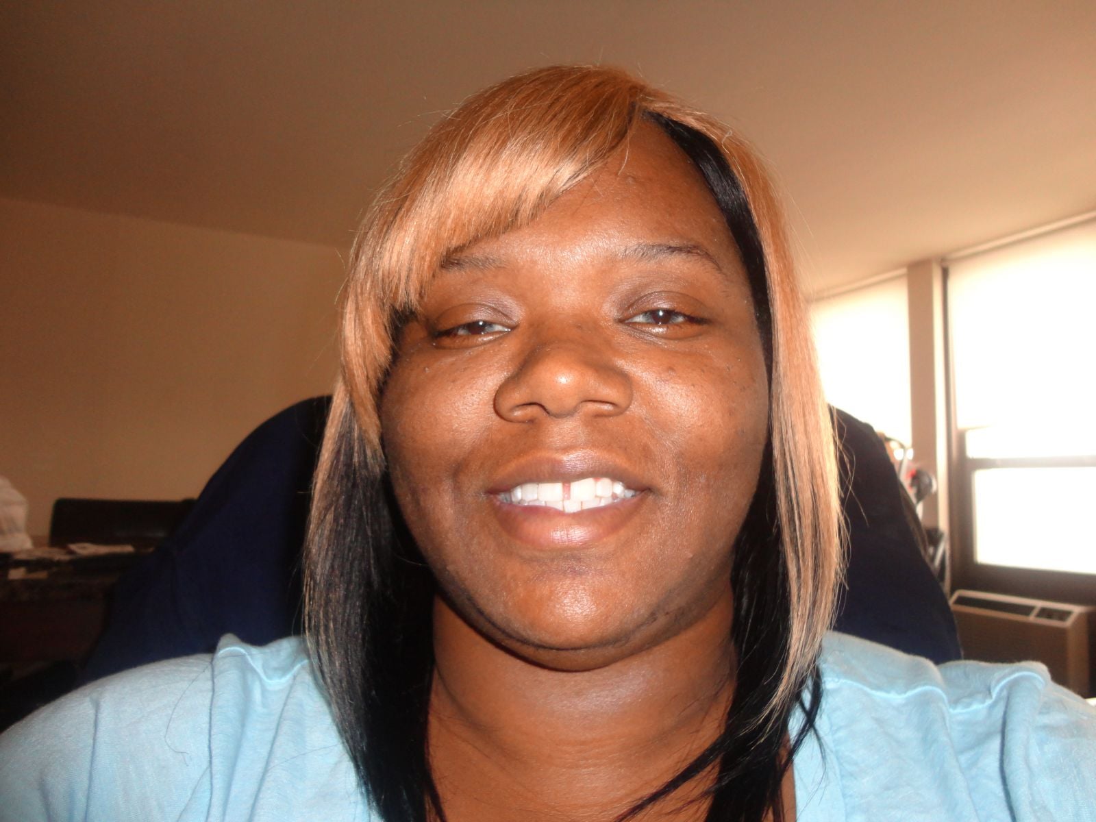 Before Sugery Photos